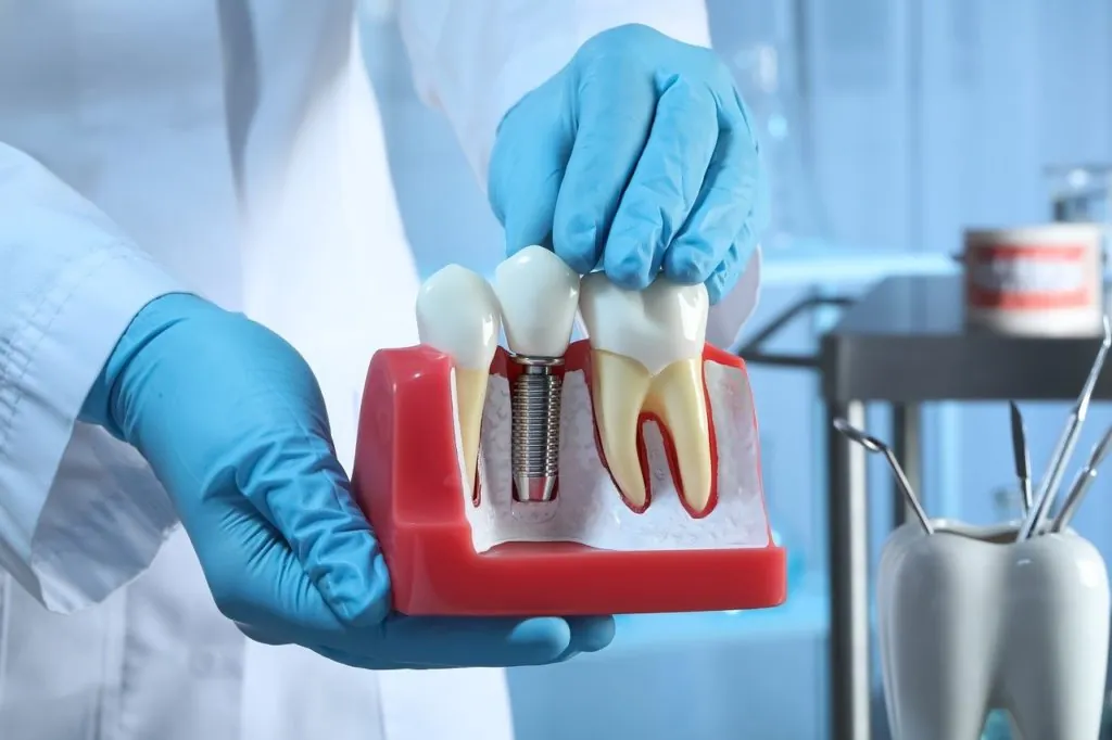 Zahnzusatzversicherung vergleichen und sparen